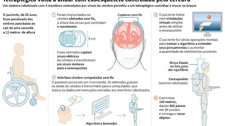 Tetraplégico volta a andar com exoesqueleto controlado pelo cérebro ...