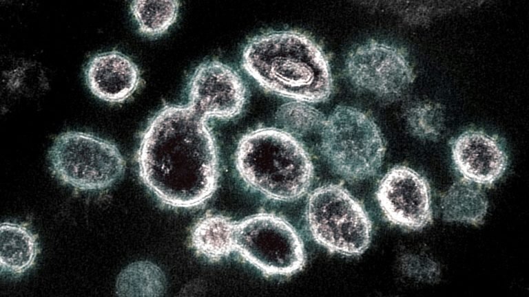 Crédito: National Institute of Allergy and Infectious Diseases/AFP/Arquivos Crédito: National Institute of Allergy and Infectious Diseases/AFP/Arquivos