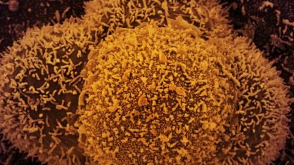 Subvariante da ômicron pode ser mais agressiva e atingir pulmões, diz pesquisa