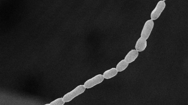Imagem microscópica tridimensional divulgada em 23  de junho de 2022 pelo laboratório nacional Lawrence Berkeley, da bactéria gigante 'Thiomargarita magnifica' - Lawrence Berkeley National Laboratory/AFP